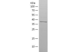 Western Blotting (WB) image for Ras Homolog Gene Family, Member A (RHOA) (AA 61-193) protein (His-IF2DI Tag) (ABIN7124783) (RHOA Protein (AA 61-193) (His-IF2DI Tag))
