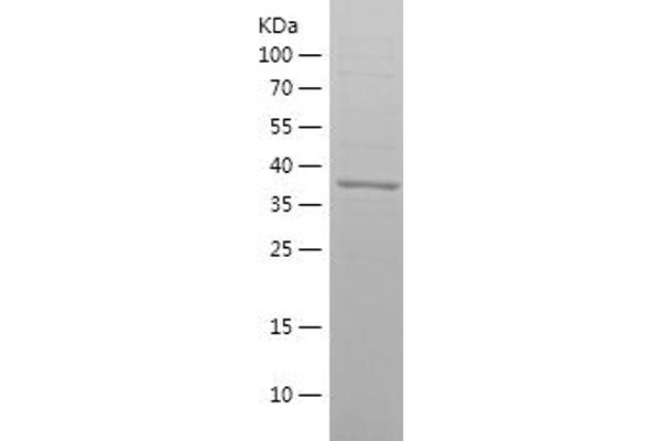 RHOA Protein (AA 61-193) (His-IF2DI Tag)