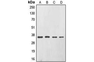 Western blot analysis of CD326 expression in A431 (A), SW480 (B), HepG2 (C), Caco2 (D) whole cell lysates. (EpCAM 抗体  (Center))