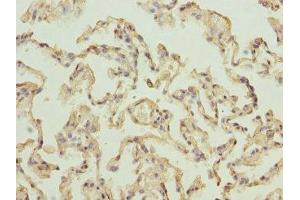 Immunohistochemistry of paraffin-embedded human lung tissue using ABIN7142727 at dilution of 1:100 (RPLP2 抗体  (AA 1-115))
