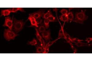 ABIN6275704 staining HuvEc by IF/ICC. (ZADH2 抗体  (Internal Region))