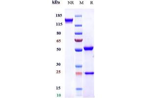 Anti-FGFR4 / CD334 Reference Antibody (U3-1784) on SDS-PAGE under reducing (R) condition. (Recombinant FGFR4 抗体)