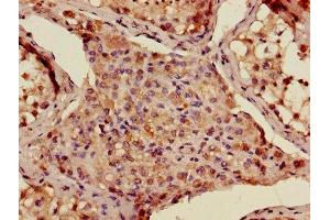 Immunohistochemistry of paraffin-embedded human testis tissue using ABIN7142874 at dilution of 1:100 (ADAMTS12 抗体  (AA 26-229))
