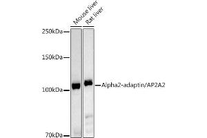 Western blot analysis of extracts of various cell lines, using Alph-adaptin/ antibody (ABIN6130980, ABIN6136955, ABIN6136957 and ABIN6221039) at 1:1000 dilution. (AP2A2 抗体  (AA 590-939))