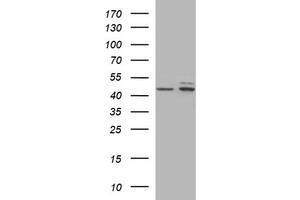 Image no. 1 for anti-Tubulin, beta 2B (TUBB2B) antibody (ABIN1501574) (TUBB2B 抗体)
