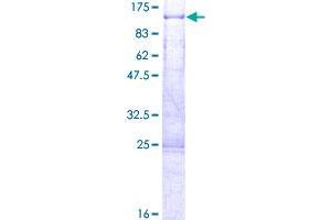 CTIF/KIAA0427 Protein (AA 1-598) (GST tag)