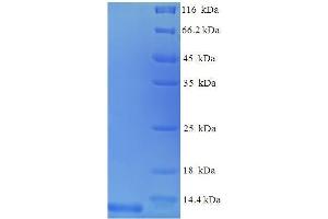 Chemokine (C-C Motif) Ligand 3 (CCL3) (AA 24-92), (full length) protein (His tag)