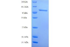 Retinol Dehydrogenase 12 (All-Trans/9-Cis/11-Cis) (RDH12) (AA 1-316), (full length) protein (His-SUMO Tag)