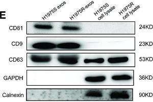 Establishment of osimertinib-resistant H1975 cell lines. (CD63 抗体)