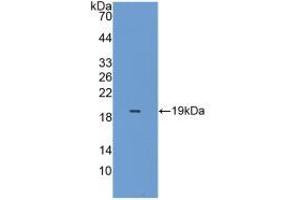 Western blot analysis of the recombinant protein. (Peroxiredoxin 5 抗体  (AA 49-210))