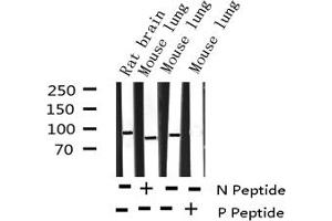 Western blot analysis of Phospho-p95/NBS1 (Ser343) expression in various lysates (Nibrin 抗体  (pSer343))