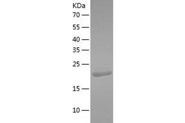 BCL7C Protein (AA 1-217) (His tag)