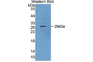Western blot analysis of the recombinant protein. (KPNA3 抗体  (AA 3-220))