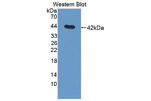 Western blot analysis of the recombinant protein. (C3 抗体  (AA 965-1303))