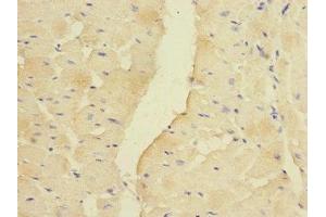 Immunohistochemistry of paraffin-embedded human heart tissue using ABIN7142007 at dilution of 1:100 (PDK3 抗体  (AA 137-406))