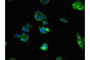 Immunofluorescent analysis of HepG2 cells using ABIN7167318 at dilution of 1:100 and Alexa Fluor 488-congugated AffiniPure Goat Anti-Rabbit IgG(H+L) (RAB39B 抗体  (AA 1-213))