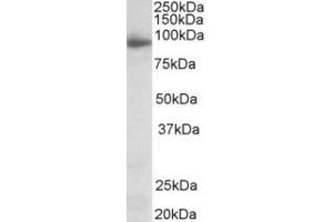 Western Blotting (WB) image for anti-Neuroligin 4 (NLGN4) (Internal Region) antibody (ABIN2465126) (Neuroligin 4 抗体  (Internal Region))