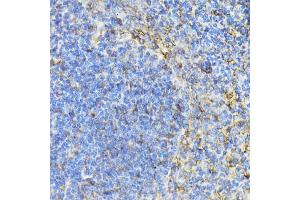 Immunohistochemistry of paraffin-embedded mouse spleen using STAT4 antibody (ABIN5974204) at dilution of 1/100 (40x lens). (STAT4 抗体)