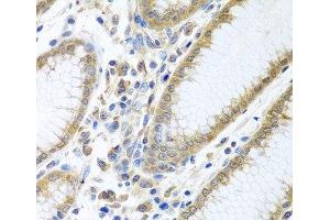 Immunohistochemistry of paraffin-embedded Human stomach using EIF4E Polyclonal Antibody at dilution of 1:100 (40x lens). (EIF4E 抗体)