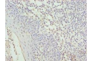 Immunohistochemistry of paraffin-embedded human tonsil tissue using ABIN7149090 at dilution of 1:100 (CYBC1 (AA 43-187) 抗体)