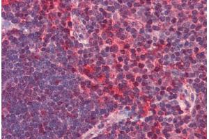 Human Thymus (formalin-fixed, paraffin-embedded) stained with CXCR6 antibody ABIN351436 at 2. (CXCR6 抗体  (N-Term))