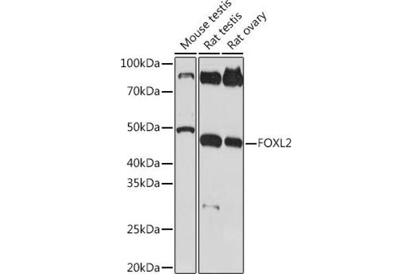 FOXL2 抗体