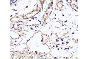 Immunohistochemistry of paraffin-embedded Human colon using VEGF Monoclonal Antibody at dilution of 1:150 (40x lens). (VEGF 抗体)