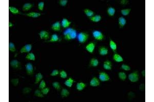Immunofluorescence (IF) image for anti-Catenin (Cadherin-Associated Protein), beta 1, 88kDa (CTNNB1) (AA 2-781) antibody (ABIN7146984)