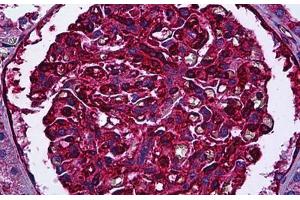 Human Kidney, Glomeruli: Formalin-Fixed, Paraffin-Embedded (FFPE) (Myosin 9 抗体)