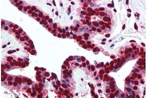 Human Breast (formalin-fixed, paraffin-embedded) stained with Histone H2A antibody ABIN291582 at 5 ug/ml followed by biotinylated goat anti-rabbit IgG secondary antibody ABIN481713, alkaline phosphatase-streptavidin and chromogen. (Histone H2A 抗体  (AA 1-15))