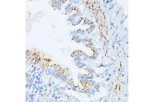 Immunohistochemistry of paraffin-embedded rat lung using IL3RA antibody (ABIN1680453, ABIN3018298, ABIN3018299, ABIN5664529 and ABIN6220429) at dilution of 1:100 (40x lens). (IL3RA 抗体  (AA 1-100))