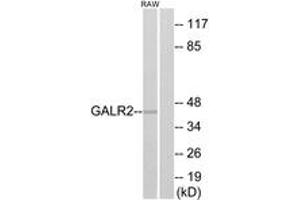 Western blot analysis of extracts from RAW264. (GALR2 抗体  (AA 201-250))