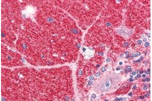 Human Brain, Cerebellum (formalin-fixed, paraffin-embedded) stained with DISC1 antibody ABIN351527 at 5 ug/ml followed by biotinylated goat anti-rabbit IgG secondary antibody ABIN481713, alkaline phosphatase-streptavidin and chromogen. (DISC1 抗体  (C-Term))