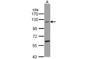 WB Image Sample(30 ug whole cell lysate) A:A431, 7. (UBA7 抗体  (N-Term))
