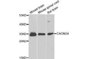 Western blot analysis of extracts of various cell lines, using CACNG4 antibody. (CACNG4 抗体)