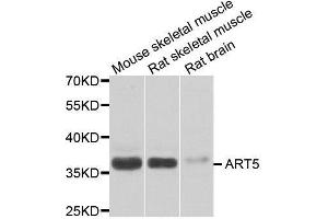 Western blot analysis of extracts of various cell lines, using ART5 antibody. (ART5 抗体  (AA 23-200))