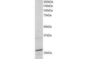 Image no. 1 for anti-RAB11A, Member RAS Oncogene Family (RAB11A) (C-Term) antibody (ABIN374252) (RAB11A 抗体  (C-Term))