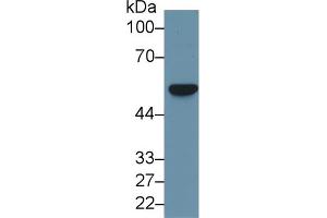Western Blot; Sample: Human Hela cell lysate; Primary Ab: 1µg/ml Rabbit Anti-Rat FSCN Antibody Second Ab: 0. (Fascin 抗体  (AA 8-260))