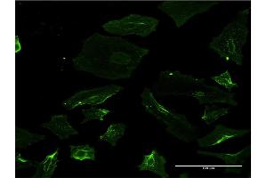Immunofluorescence (IF) image for anti-Spastin (SPAST) (AA 200-304) antibody (ABIN520426)