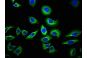 Immunofluorescence staining of A549 cells with ABIN7145194 at 1:66, counter-stained with DAPI. (NAIP 抗体  (AA 147-242))