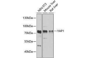 Western blot analysis of extracts of various cell lines, using Y antibody (ABIN6132789, ABIN6150317, ABIN6150322 and ABIN6215136) at 1:1000 dilution. (YAP1 抗体  (AA 155-504))