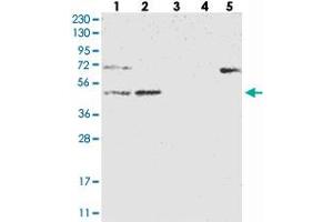 Western blot analysis of Lane 1: RT-4, Lane 2: U-251 MG, Lane 3: Human Plasma, Lane 4: Liver, Lane 5: Tonsil with NT5DC1 polyclonal antibody . (NT5DC1 抗体)