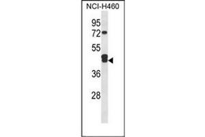 Western blot analysis of IDH3G Antibody (C-term) in NCI-H460 cell line lysates (35ug/lane). (IDH3G 抗体  (C-Term))