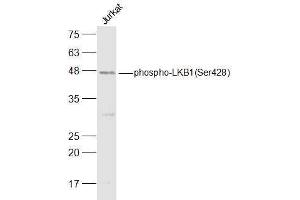 Jurkat lysates probed with LKB1(Ser428) Polyclonal Antibody, Unconjugated  at 1:500 dilution and 4˚C overnight incubation. (LKB1 抗体  (pSer428))