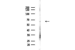 Western blot analysis of lysates from Mouse liver, using IL1RAP Antibody at 1/1000 dilution.