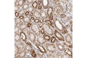 Immunohistochemical staining of human kidney with SLC25A26 polyclonal antibody  shows strong granular cytoplasmic positivity in tubular cells. (SLC25A26 抗体)