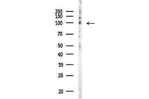 anti-PHD Finger Protein 16 (PHF16) antibody