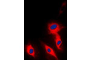 Immunofluorescent analysis of Ephrin A5 staining in Hela cells. (Ephrin A5 抗体  (Center))
