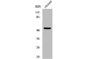 Western Blot analysis of COLO205 cells using Melanopsin Polyclonal Antibody (OPN4 抗体  (C-Term))