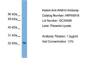 WB Suggested Anti-RAB15  Antibody Titration: 0. (RAB15 抗体  (Middle Region))